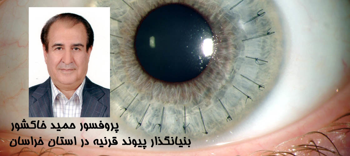 دکتر جراح چشم در مشهد